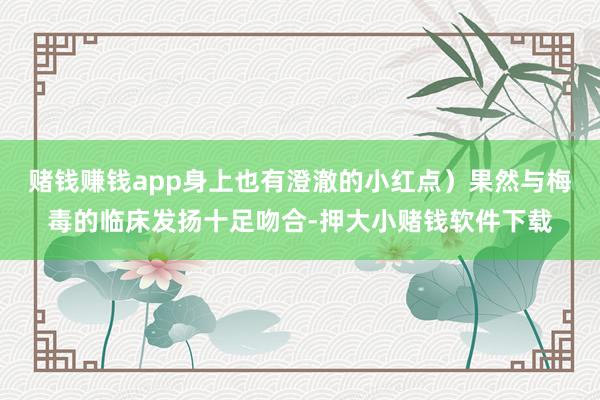 赌钱赚钱app身上也有澄澈的小红点）果然与梅毒的临床发扬十足吻合-押大小赌钱软件下载